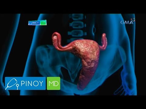 Pinoy MD: How to detect cervical cancer?