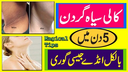 Neck Whitening Tips In Urdu | Kali Siya Gardan Ko Gora Karne Ki Tips