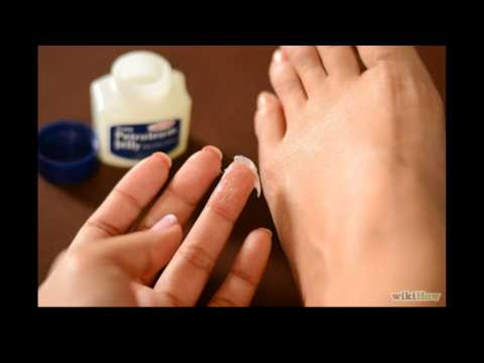 Masalah pada kaki dan solusinya
