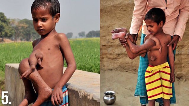 САМЫЕ НЕОБЫЧНЫЕ ДЕТИ НА ЗЕМЛЕ