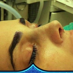 عمليات تجميل الانف في ايران (3)