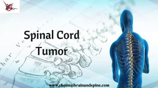 Spinal Cord Tumor Treatment In Chennai | Best Spine Surgery In India