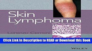 Read Book Skin Lymphoma: The Illustrated Guide Free Books