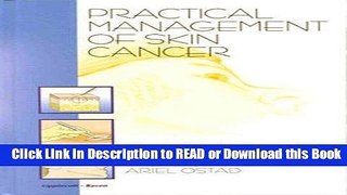 Read Book Practical Management of Skin Cancer Free Books