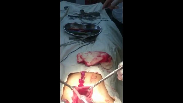 25 brosses à dents dans le ventre