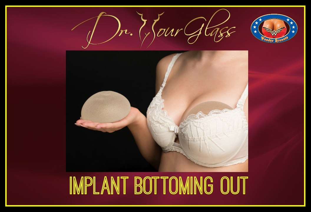 Implants Bottoming Out