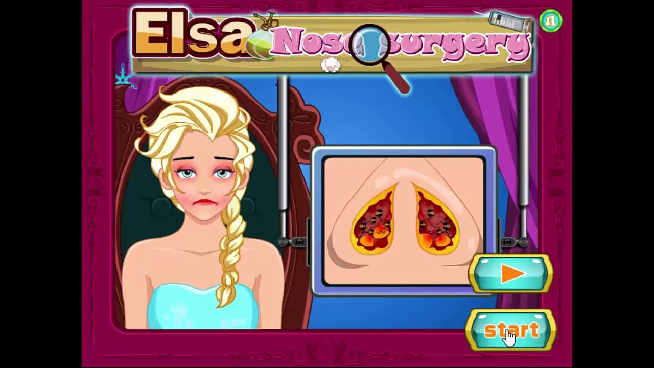 Elsa Nose Surgery - Disney Princess Elsa Game - Doctor Game For Kids