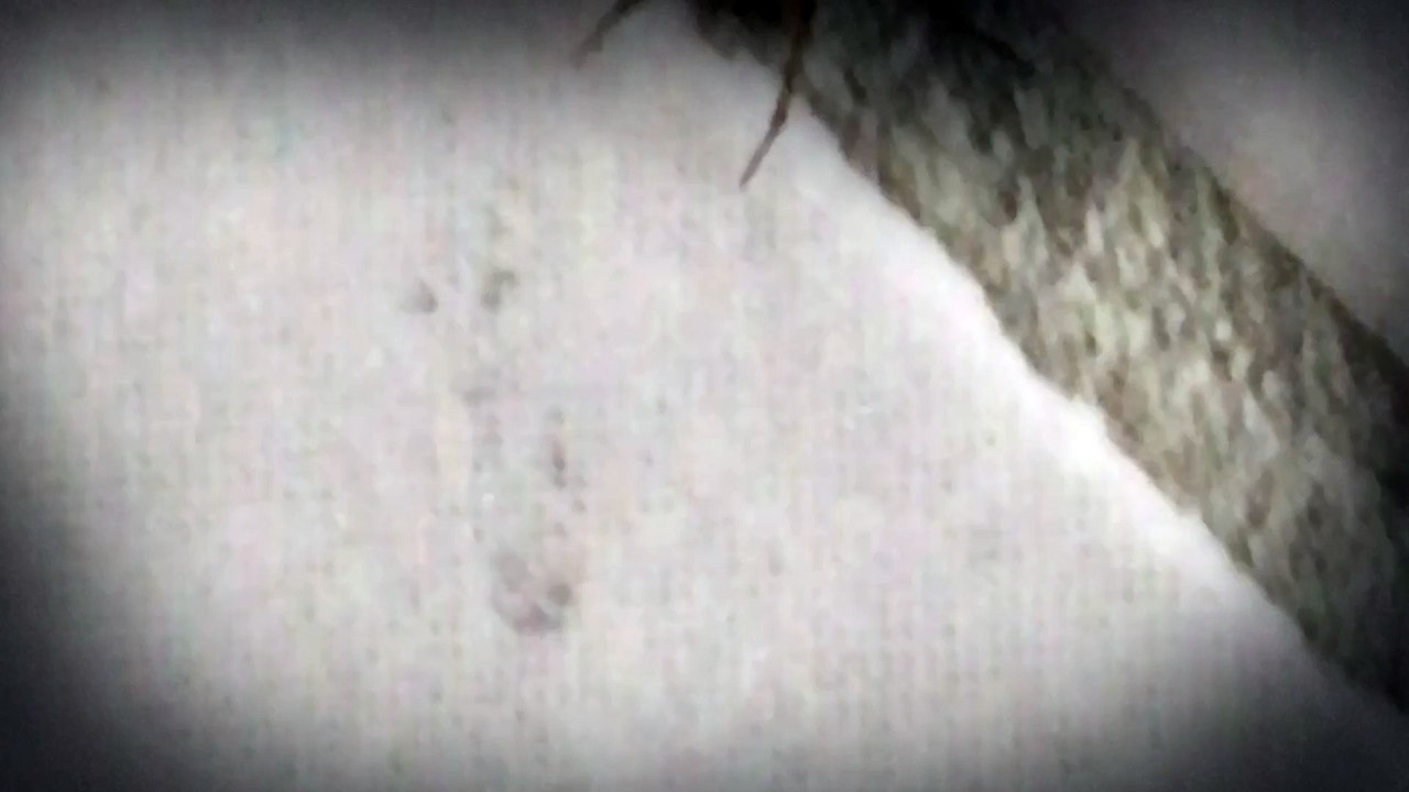 Teaser (Dona Aranha)