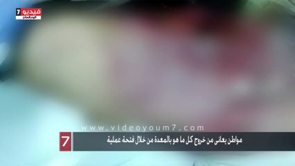 بالفيديو.. واقعة إهمال جديدة بمستشفى كفر الدوار.. مواطن يعانى من خروج كل ما هو بالمعدة من خلال فتحة عملية