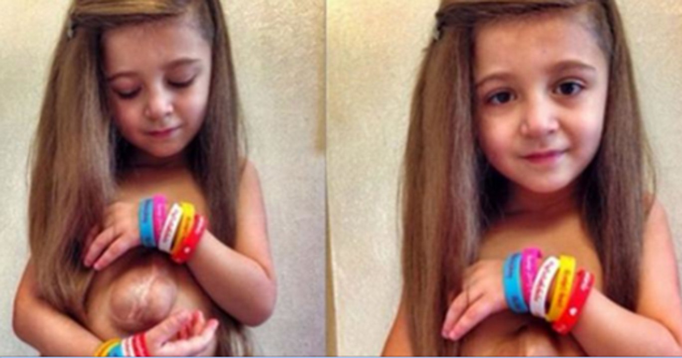 7 years old girl born with heart outside her chest is hoping for operation