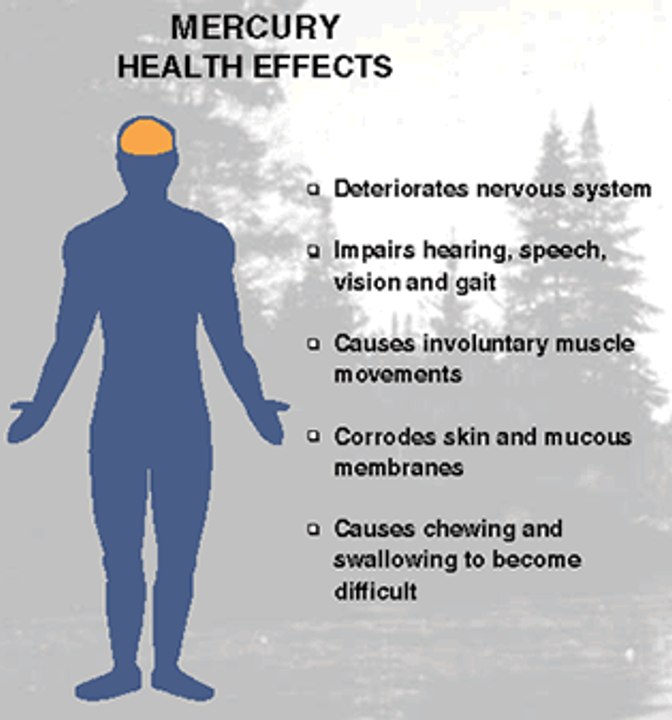 How Chelation Therapy Is Performed