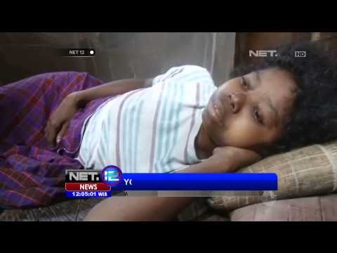 9 Anak Meninggal Terserang Penyakit Campak - NET12