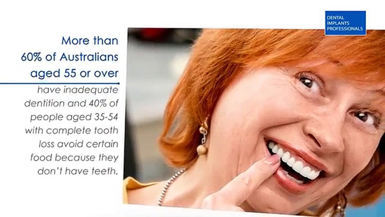 Benefits of Dental Implants in Sydney| Watch Now