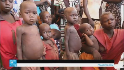 مليون و400 ألف طفل عرضة للموت جوعا