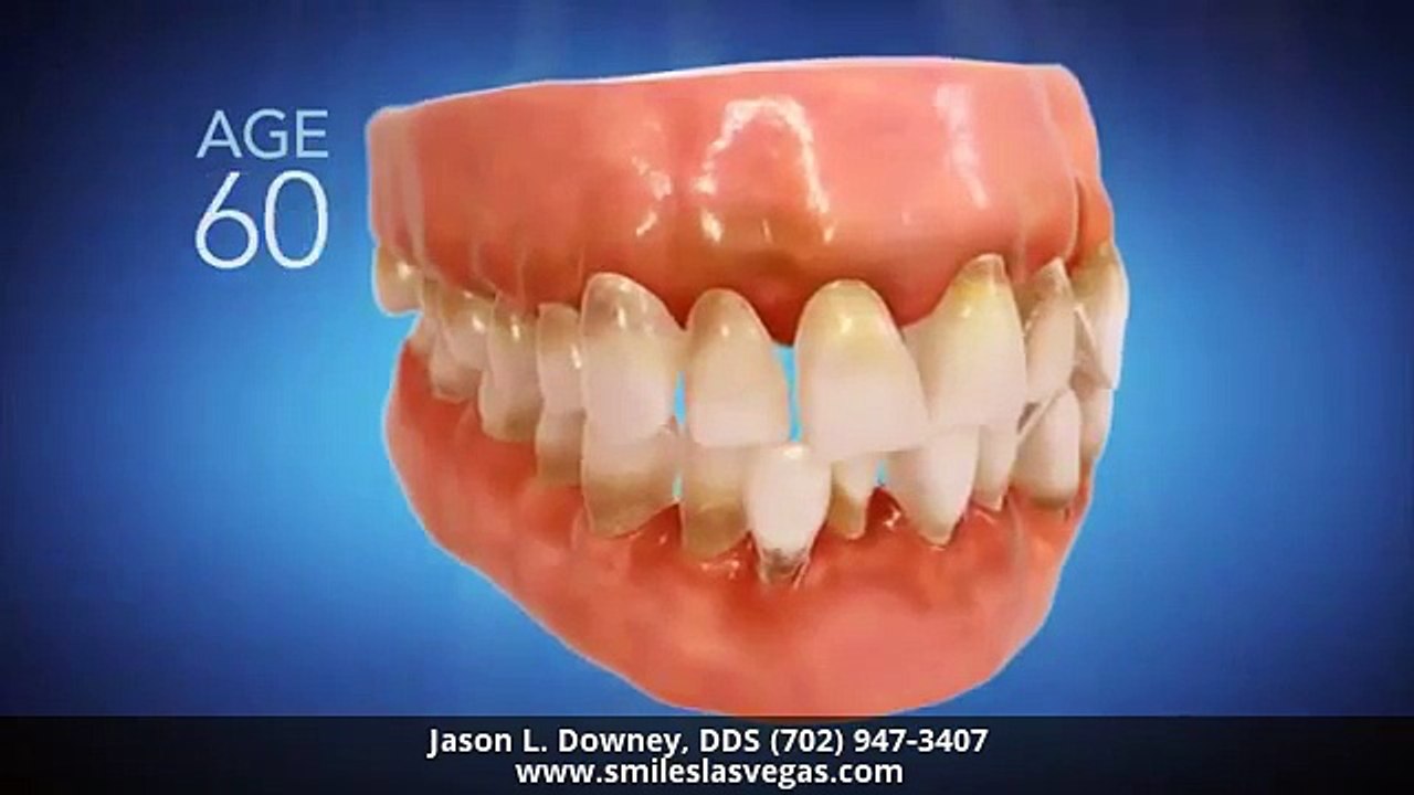 Invisalign Dentist Las Vegas NV