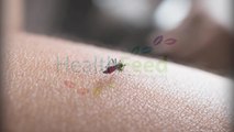Malaria Provides a Satisfying Aroma For Mosquitoes
