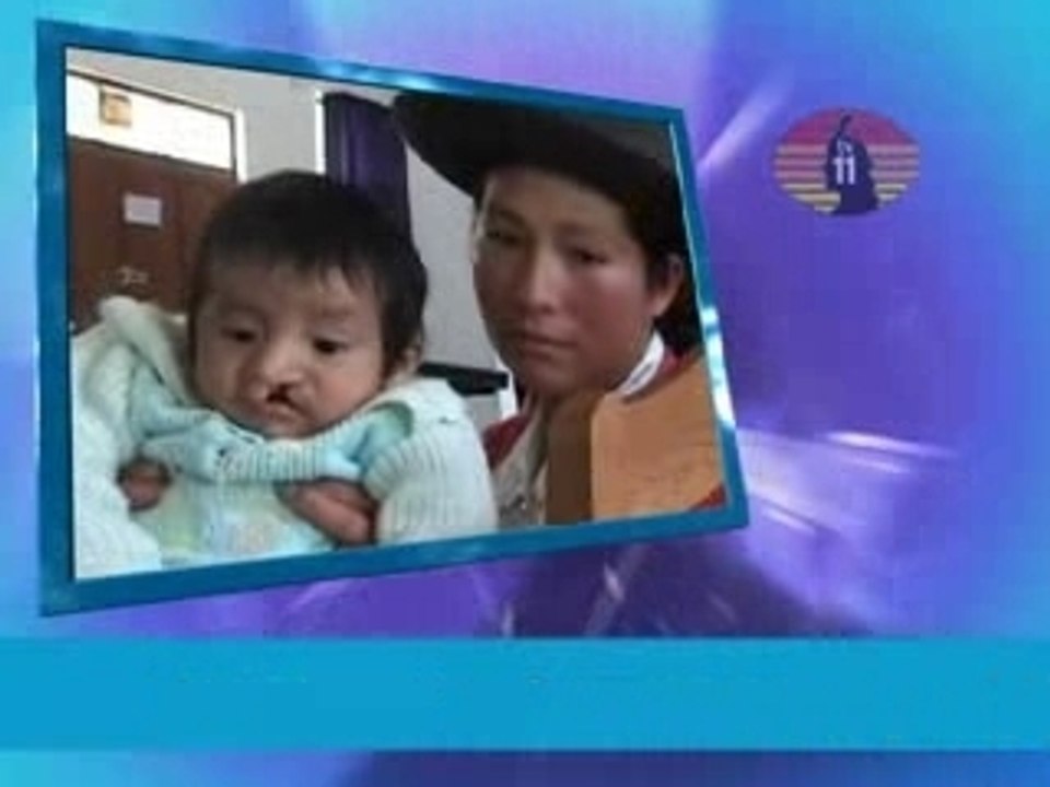 OPERACIONES GRATUITAS - ANDAHUAYLAS