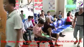 Bệnh Gút có chữa được dứt điểm hay không? Phòng và điều trị Gút