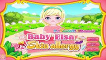 Baby Elsa Skin Allergy - Disney Frozen Princes Elsa Doctor Care Game for Kids