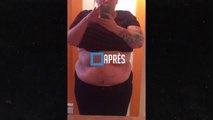Cette femme obèse de 366 kg va perdre 60 kg en 2 mois