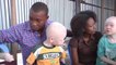 Rd congo, Intégration sociale des Albinos/les albinos se prennent en charge