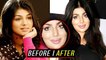 Ayesha Takia's SHOCKING LIP SURGERY GONE WRONG! | Plastic Surgery