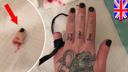 Woman so hipster she cuts off pinky finger and posts pics