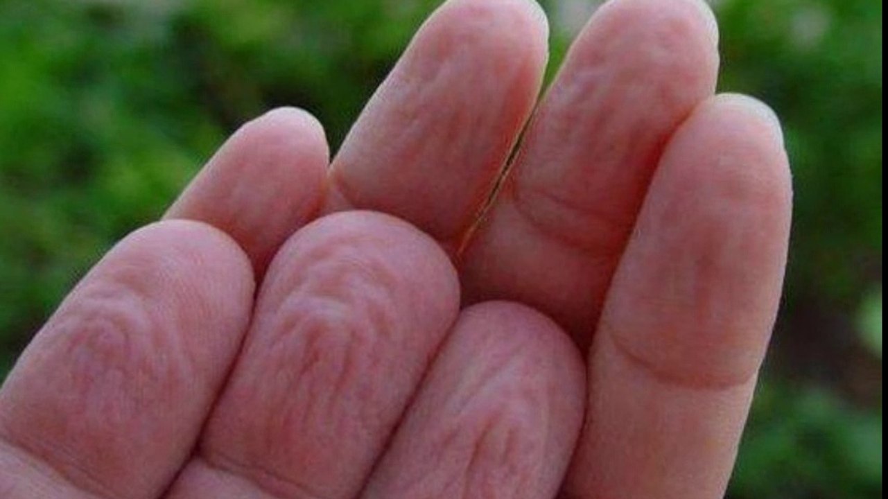 ما هو سبب تجعد جلد الأصابع في الماء ؟