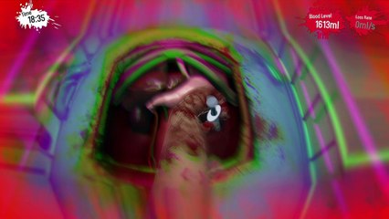 Kidney transplant Part Two The Movie