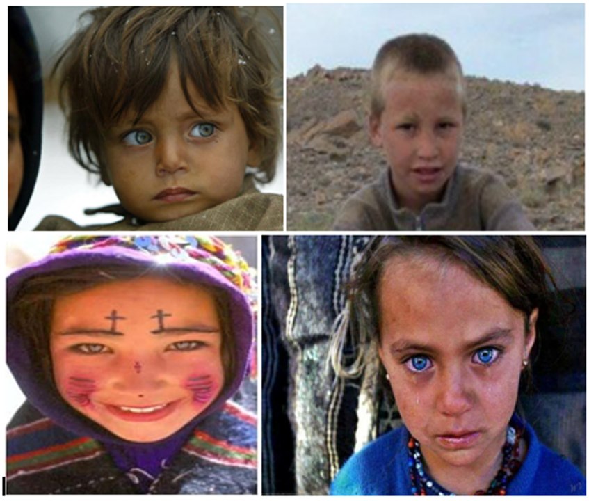 the Atlasian phenotype