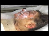 Gjirokastër - Iu dogj banesa, e moshuara ka marrë plagë në fytyrë dhe duar