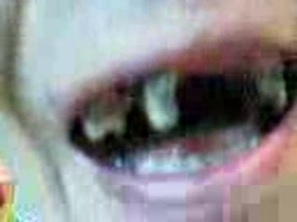 Ceux qui ont peur des dentistes venez voir ça!!!