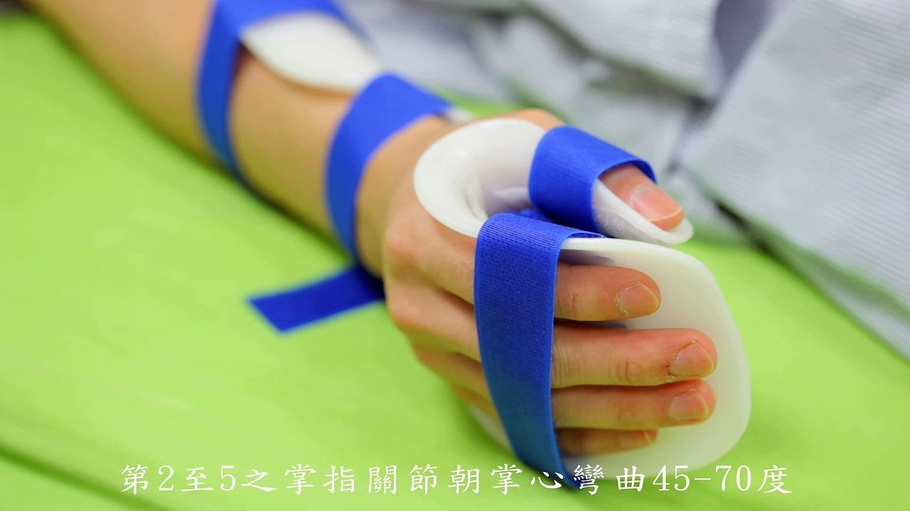 [衛教短片拍攝]燒燙傷復健/職能治療/臺北榮民總醫院復健部
