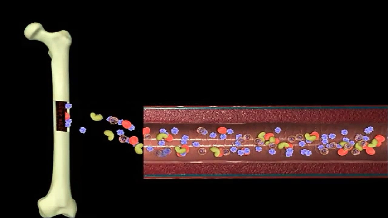 Acute myelogenous leukemia