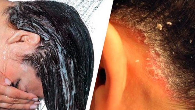 She rubbed an aspirin in her hair. What happened a few hours later is fantastic