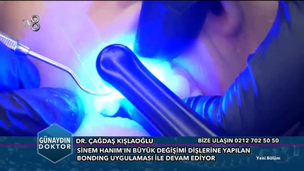 Bonding Uygulaması Nasıl Yapılır?