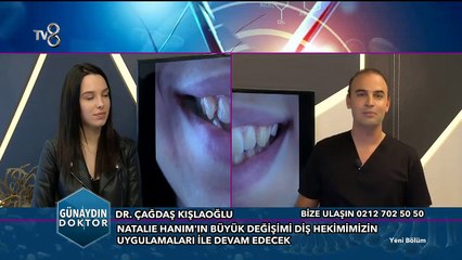 Lamine ile büyük değişim