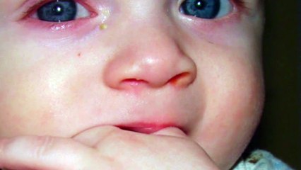 Attention, les nourrissons peuvent perdre la vue à cause de cette chose qu’on a tous l’habitude de faire !