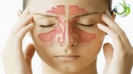 106.  With this remedy, I ended up with 1 year of sinusitis in 7 days.