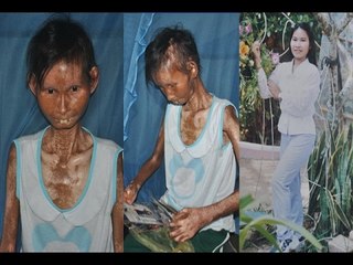 Người phụ nữ xinh đẹp mắc bệnh lạ biến thành bà cụ! [Chuyện lạ Việt Nam]