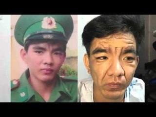 Chàng trai 23 tuổi đẹp nhất xóm biến thành... ông lão [Tin mới nhất]