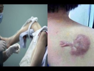 Nữ bác sĩ phá thai tạo ác nghiệp hình thù kỳ dị xuất hiện trên thân!