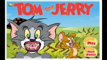 Tom y Jerry de dibujos animados Juegos | Tom al Dentista | Tom y Jerry Juegos de Médico