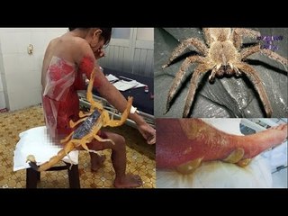 Chuyện lạ Việt Nam- 10 loài có nọc độc đáng sợ nhất thế giới.