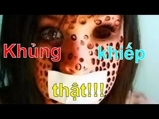 Chuyện lạ - Top 10 căn bệnh KHỦNG KHIẾP nhất mọi thời đại