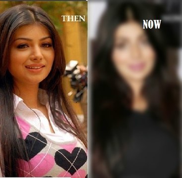Ayesha Takia Indian Actress Face Surgery Gone Wrong