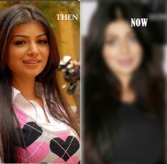 Ayesha Takia Indian Actress Face Surgery Gone Wrong