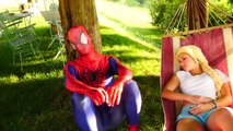 Frozen Elsa vs Joker and Doctor Wolverine Performs Surgery INSECTS! w/ Spiderman Funny Sup
