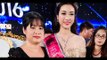 Ban tổ chức, Đỗ Mỹ Linh Hoa hậu Việt Nam chính thức lên tiếng về nghi vấn sửa răng