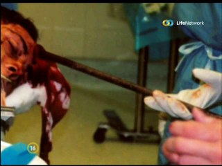 Hihetetlen Gyógyulások 2